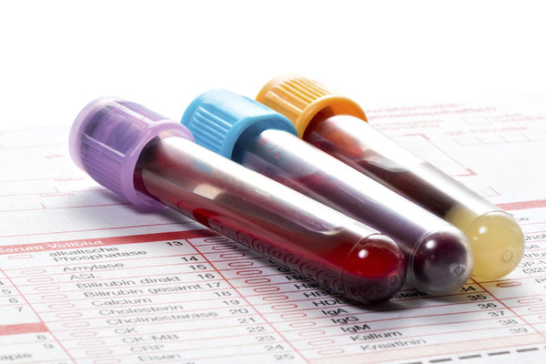 Blood work - what it tells you and what to do with it